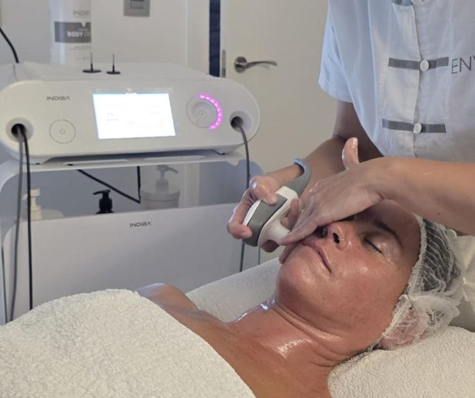 tratamientos faciales indiba