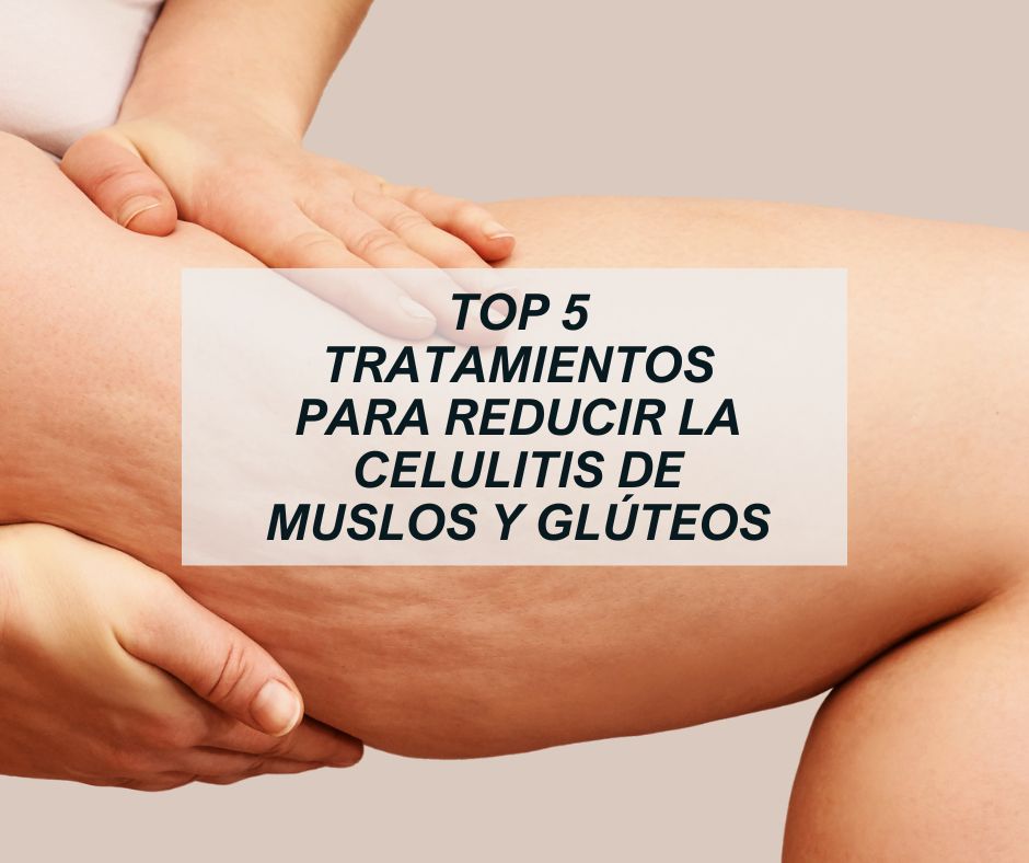 Blog reducir celulitis muslos y glúteos